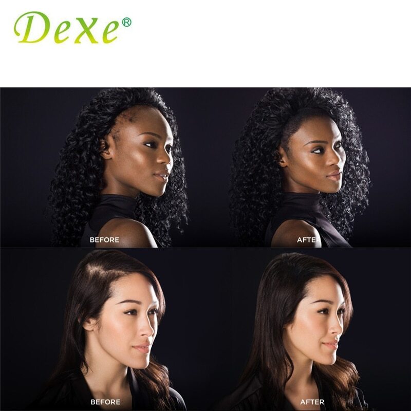 تسوق Sweethomeplanet Original Dexe 22g Hair Building Fibers + 100ml Hair Locking Spray Thicker Hair Fibers Powder Keratin Hair Loss Concealer | سوق رمان تسوق Sweethomeplanet Original Dexe 22g Hair Building Fibers + 100ml Hair Locking Spray Thicker Hair Fibers Powder Keratin Hair Loss Concealer | سوق رمان