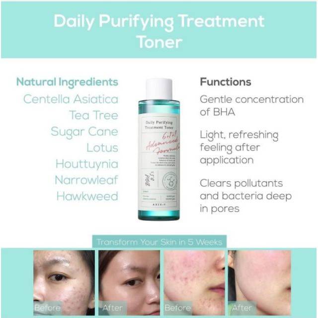 Daily Purifying Treatment Toner – AXIS-Y