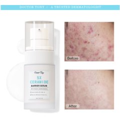 Dr. Tony 5X Ceramide Barrier Serum - 20ML