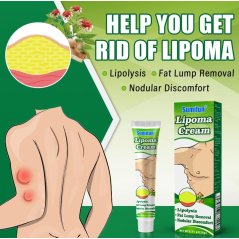 Lipoma Removal Cream Plant Extract Tumors Treat Ointment Relief - 20G