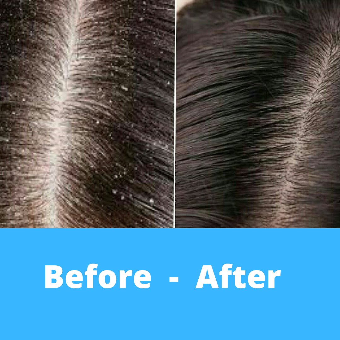 Health & Beauty Beauty Personal Care Hair Care ATTIVA Scalp