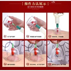Gdeal 24 Cans Set Vacuum Cupping Machine Traditional Chinese Medicine Massage Therapy Suction Acupuncture