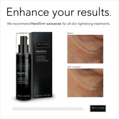Revision Skincare Nectifirm® Advanced Neck Cream 48G