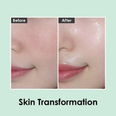 MEDI-PEEL Peptide 9 Volume White Cica Essence 3.38 fl.oz. / 100ml | White Cica Bubble and Peptides Brightening Skin | Korean Skincare, For All Skin Types