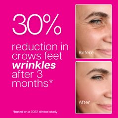 Ventamin Collagen Party Supplement for Firmer Tighter Younger Skin