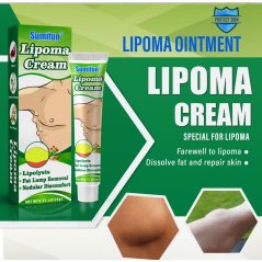 Lipoma Removal Cream Plant Extract Tumors Treat Ointment Relief - 20G