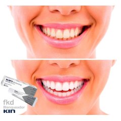 Kin Whitening Toothpaste with Fluoride 95gm