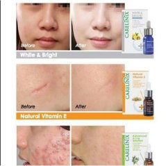 Carelinix White Hydro + ( Whitening Serum and Reduces Dark Spot ) 10ml