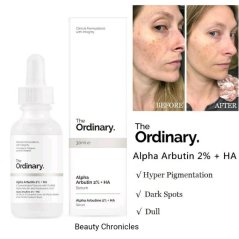 The Ordinary Niacinamide 10% + Zinc 1% Skin Brightening Serum 30ml